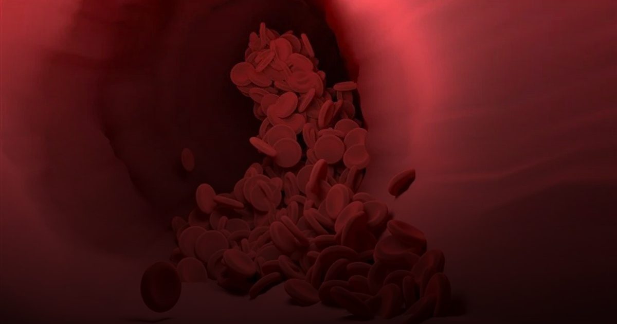 الذكاء الاصطناعي يرصد الصفائح الدموية لمنع الجلطات قبل تشكّلها