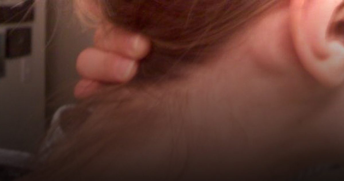 ورم بلا ألم خلف الأذن.. متى يكون إشارة خطر وتستدعي استشارة الطبيب؟