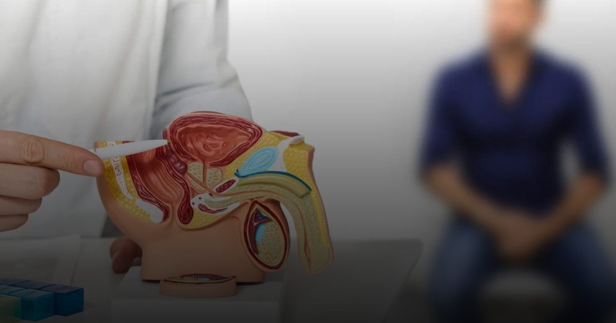 سرطان البروستاتا: الأعراض الشائعة وطرق التشخيص والعلاج المتاحة