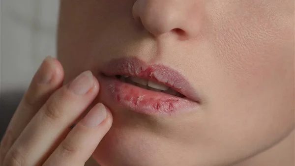 لماذا يعاني البعض من جفاف الفم عند الاستيقاظ؟