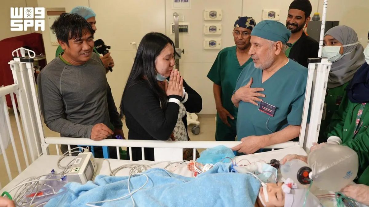 نجاح باهر في فصل التوأم الفلبيني الملتصق في الرياض