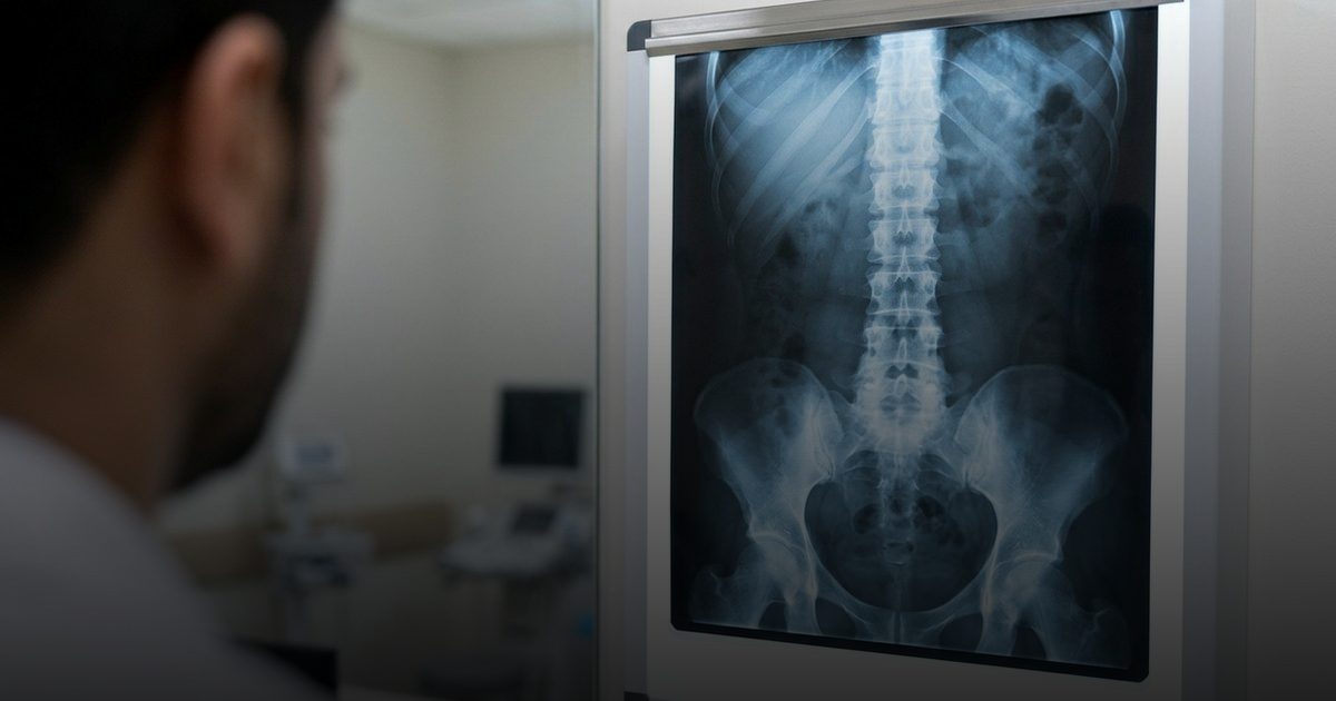 التهاب الفقرات التصلبي: أعراض وتأثيرات قد تشمل الجهاز الهضمي