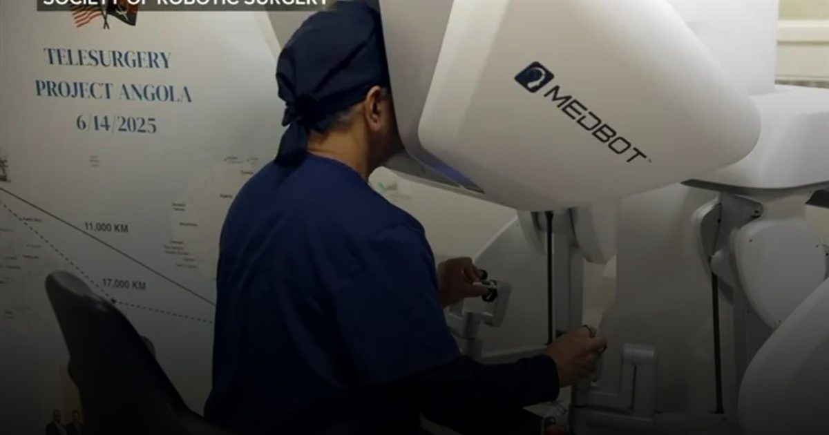 نجاح أول عملية روبوتية لمريض أنغولي على يد جراح أمريكي