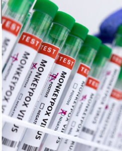 تسجيل أول إصابة بسلالة جديدة من جدري القردة في أمريكا