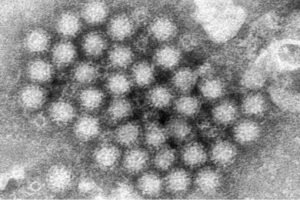 “نورو” فيروس يثير الذعر في الولايات المتحدة