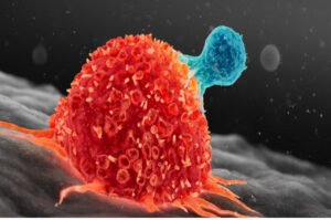 جراح يزرع “السرطان” في نفسه عن طريق الخطأ