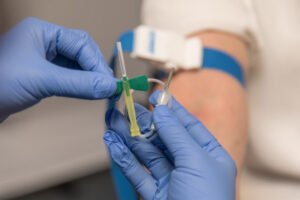 اختبار جديد يكشف سرطان البروستاتا خلال 20 دقيقة