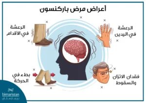 الذكاء الاصطناعي يكشف ارتباط الأحلام بمرض باركنسون