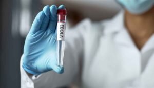 القتال في الكونغو يهدد  العالم بفيروس قاتل