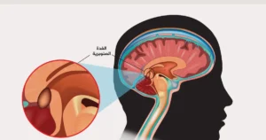 المنوّم وتأثيراته الخطيرة على الدماغ ومنها الزهايمر
