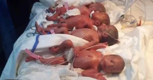 أسباب  زيادة ولادة التوائم.. منها ارتفاع معدلات علاج الخصوبة