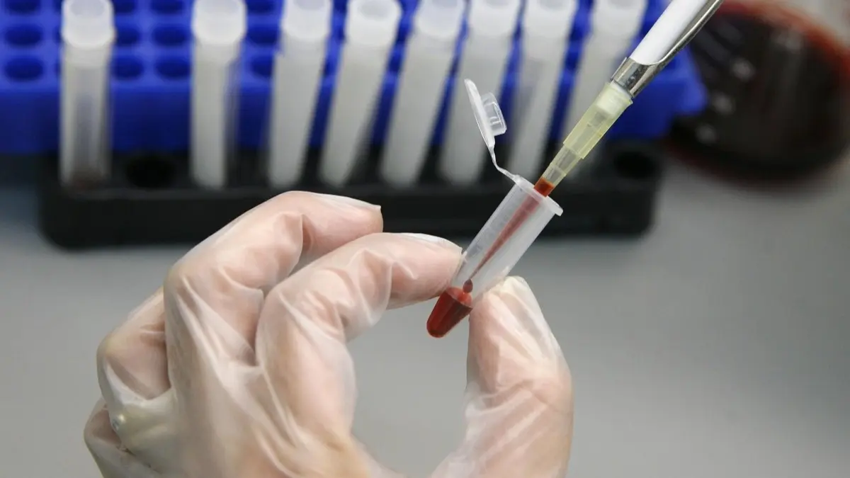 الأمم المتحدة: تجميد ترمب المساعدات الخارجية قد يتسبب في وفاة ملايين إضافيين بسبب الإيدز 