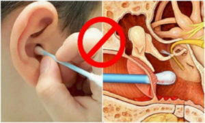 طنين الأذن.. والمشكلة في طريقة التنظيف وأشياء أخرى