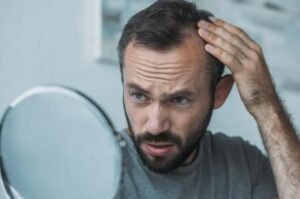 علاج جديد غير هرموني  لتساقط الشعر  والثعلبة