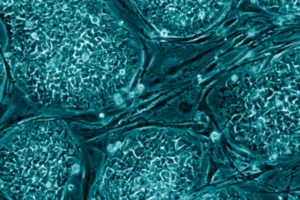 إعادة نمو الأسنان بالخلايا الجذعية والكيمياء غير العضوية