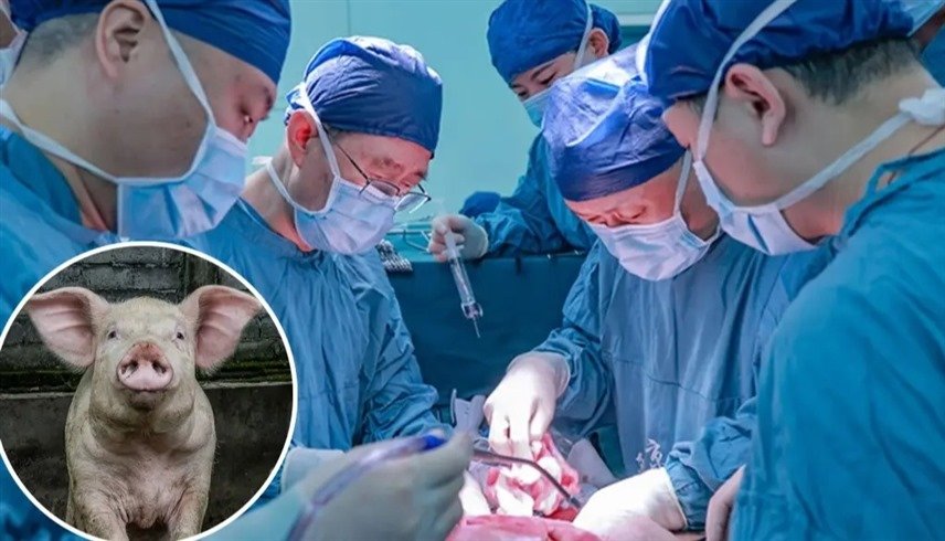 امرأة صينية ثالث شخص يعيش بكلية خنزير معدلة وراثياً 