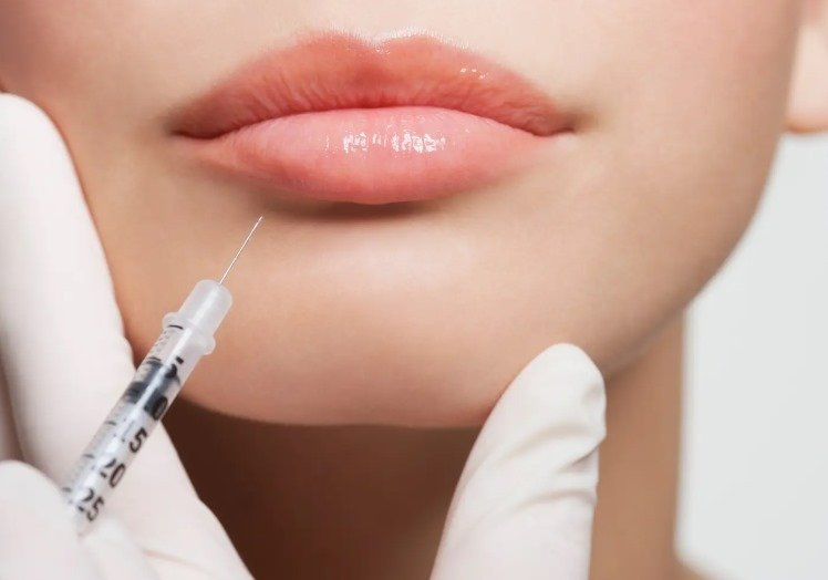 الرجال يفضلون الشفاه الطبيعية رغم هوس الفيلر 