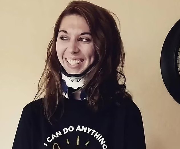  37 جراحة نادرة تنقذ امرأة بعد انفصال جمجمتها عن عمودها الفقري 