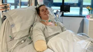 أعراض إنفلونزا تنتهي بكارثة.. طالبة تفقد أطرافها الأربعة في 5 أسابيع