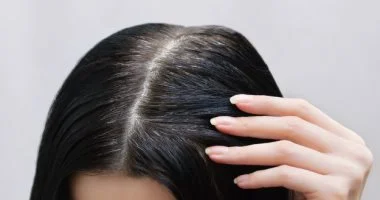 فيتامينات ومعادن ضرورية تدعم نمو الشعر وصحته 