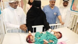انطلاق عملية فصل التوأم السعودي «يارا ولارا»
