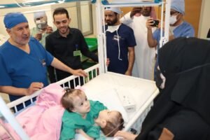 بدء عملية فصل التوأم السيامي السوري “سيلين وإيلين” في الرياض