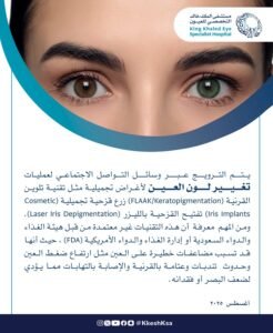 الملك خالد  التخصصي للعيون: تغيير لون العيون تقنية غير معتمدة ولها مضاعفات خطيرة