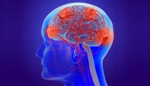 جلطات الدم في الدماغ وعلاماتها التحذيرية وطرق الوقاية