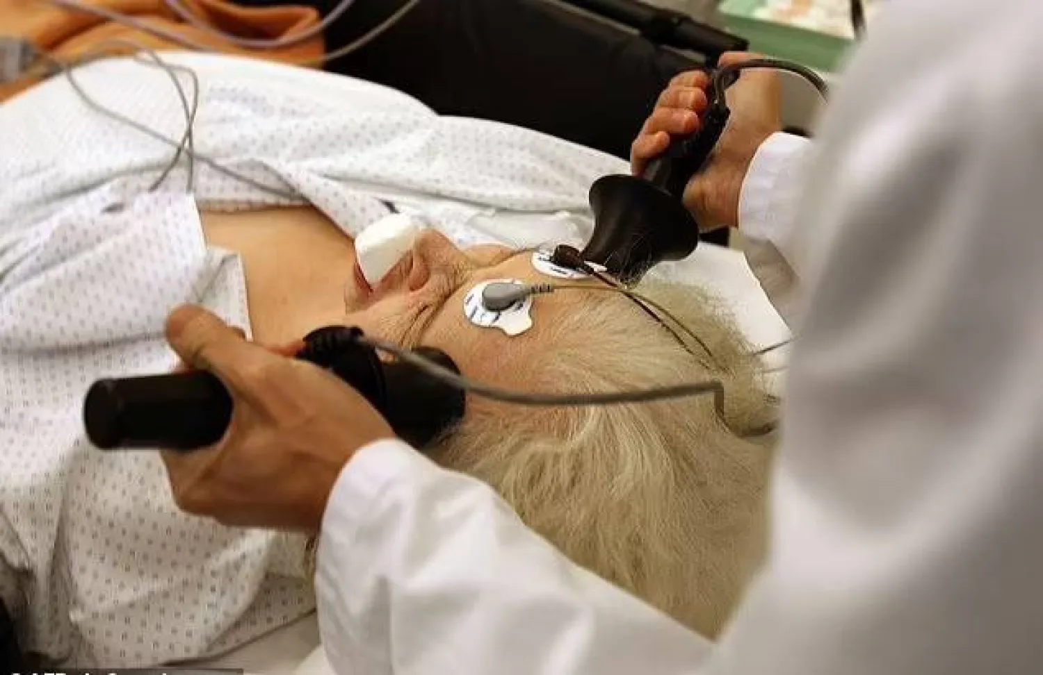 العلاج بالصدمات الكهربائية قد يُفاقم الحالة النفسية للمرضى ويزيد من خطر الانتحار 