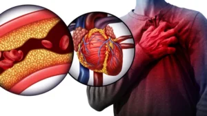أمراض القلب تؤثر على النشاط البدني قبل 12 عاماً من الإصابة