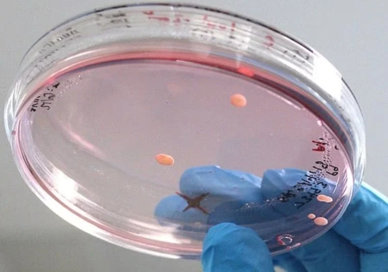 إنجاز علمي واعد في متلازمة داون.. حذف الكروموسوم الزائد يثير الأمل والتحديات 