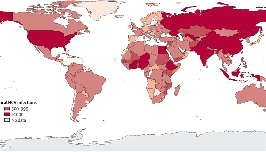 74 ألف طفل يولدون سنوياً بفيروس “سي” عالمياً.. 
