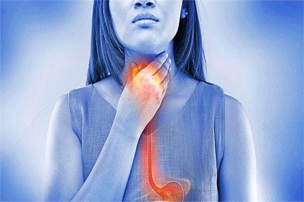 حلول غير دوائية للارتجاع.. العلاج يبدأ من المطبخ والعادات اليومية 