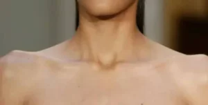 محيط الرقبة قد يكشف الكثير عن صحة القلب