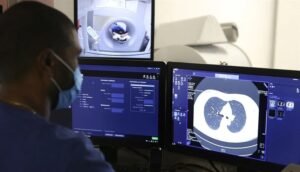 دراسة عالمية: وفيات السرطان تتخطى 18.5 مليون حالة سنوياً بحلول 2050