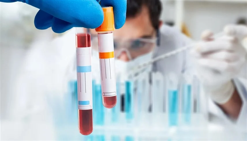 فحص جديد يكتشف سرطان الرأس والرقبة قبل 10 سنوات من ظهوره 