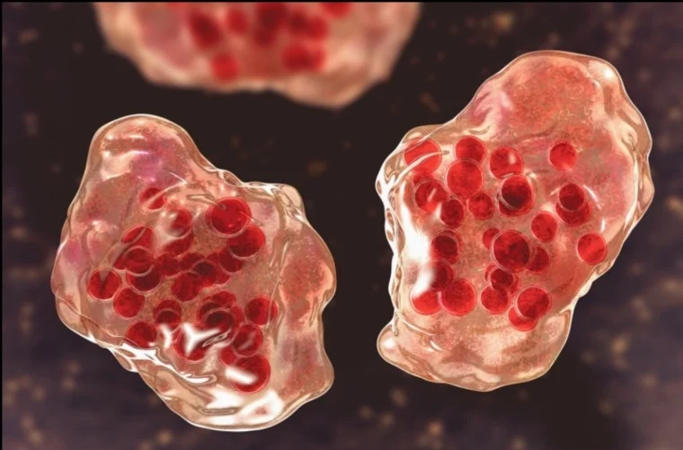 وفاة طفل بعد تعافيه من الحصبة تدق ناقوس الخطر 