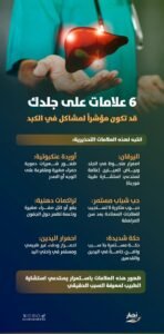 خبراء يحددون 6 علامات جلدية تحذيرية قد تشير إلى وجود مشكلات خطيرة في الكبد
