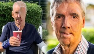 تقنية طبية مُبتكرة: بريطاني يحصل على أول وجه صناعي مطبوع بتقنية 3D بعد حادث مروع