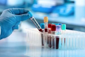 د.عسيري: التحقق المتأني من السلوك أدق من فحص المخدرات قبل الزواج