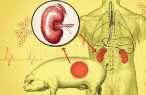 دراسات تكشف الخلايا المناعية للعضو المزروع هي سر رفض كلية الخنزير