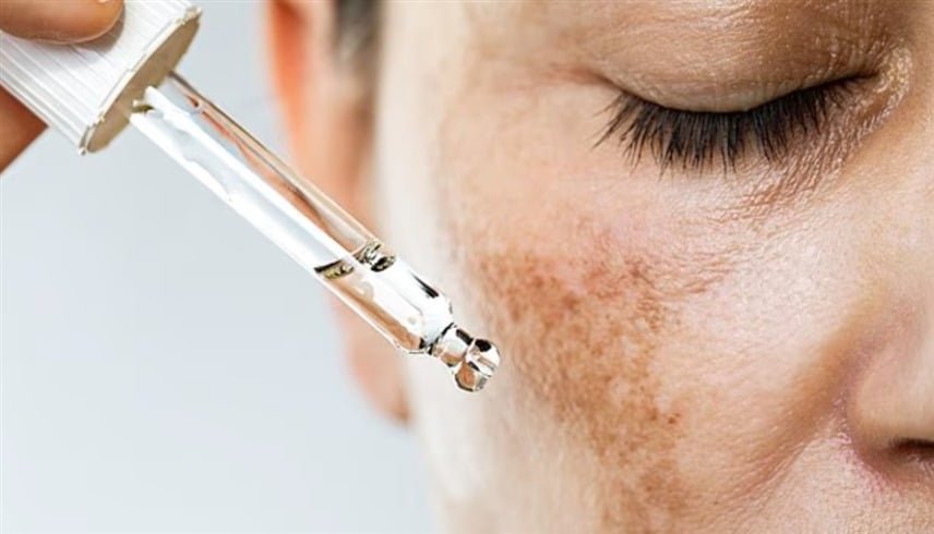 عادات يومية تزيد التصبغ وتعيق علاج البقع الداكنة 