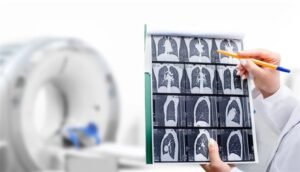 دراسة: توسيع فحص سرطان الرئة يضاعف الوفيات المتجنَّبة 3 مرات بين المدخنين