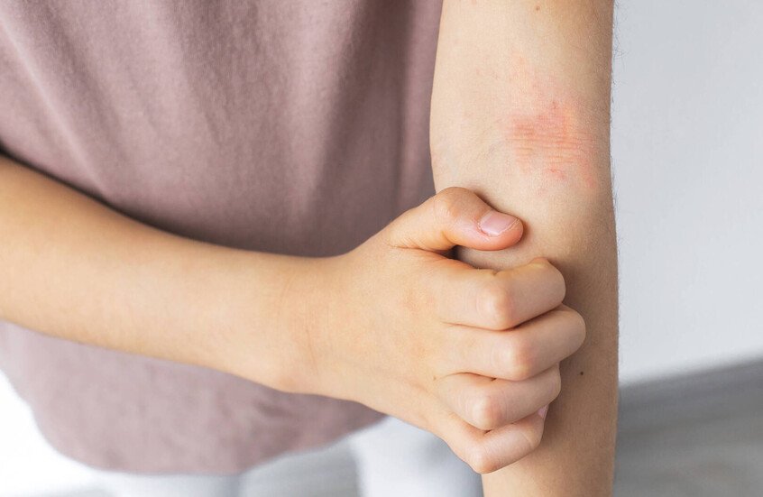 أمراض جلدية تتفاقم في الخريف والشتاء.. نصائح للتعامل مع الإكزيما والصدفية 