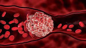 علماء صينيون يبتكرون “نانو-ميلانين” آمنة تمنع الجلطات الدموية دون مخاطر النزيف