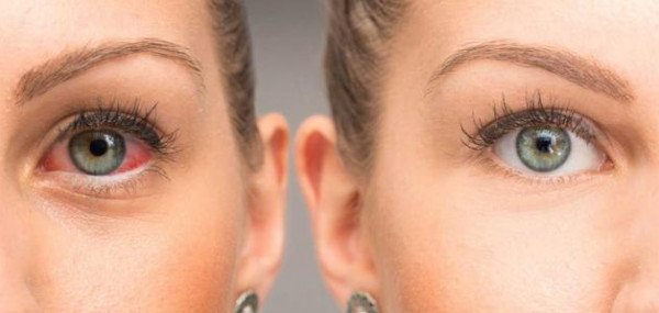 تحذير طبي: متلازمة “شوجرن” الأكثر شيوعاً بين المناعة الذاتية… والكشف المبكر يمنع الأورام 