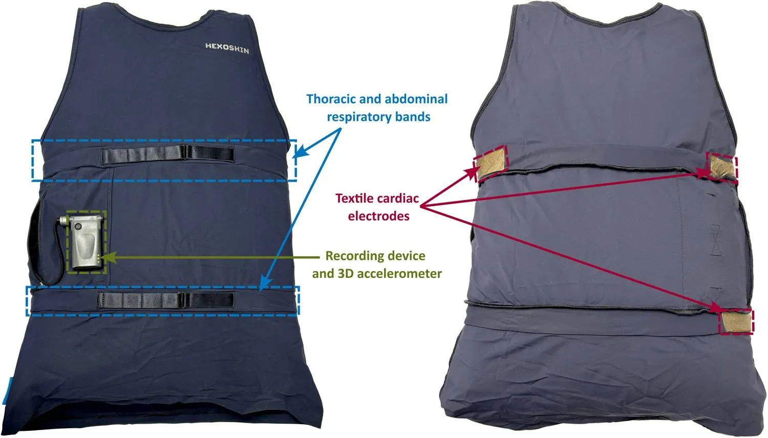 حل تقني لراحة الأسر: قميص ذكي يمنح مرضى الصرع استقلالية ويؤمّن لياليهم 
