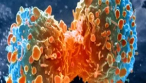 آلية جديدة تعيد الأمل لمرضى  سرطان البنكرياس