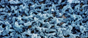 إثيوبيا تؤكد تفشي وباء “ماربورغ” في جنوب البلاد