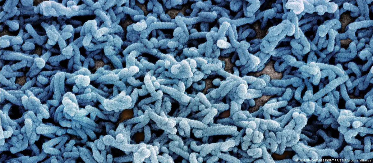 إثيوبيا تؤكد تفشي وباء “ماربورغ” في جنوب البلاد 